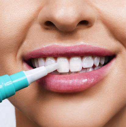 Teeth Whitening