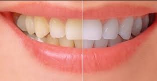 Cosmetic Dentistry