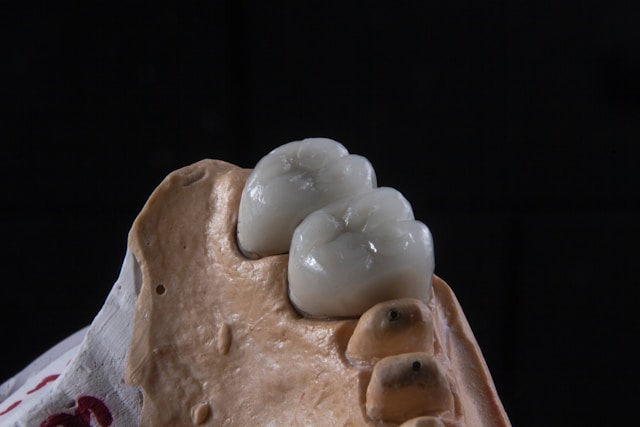 restorative dental​