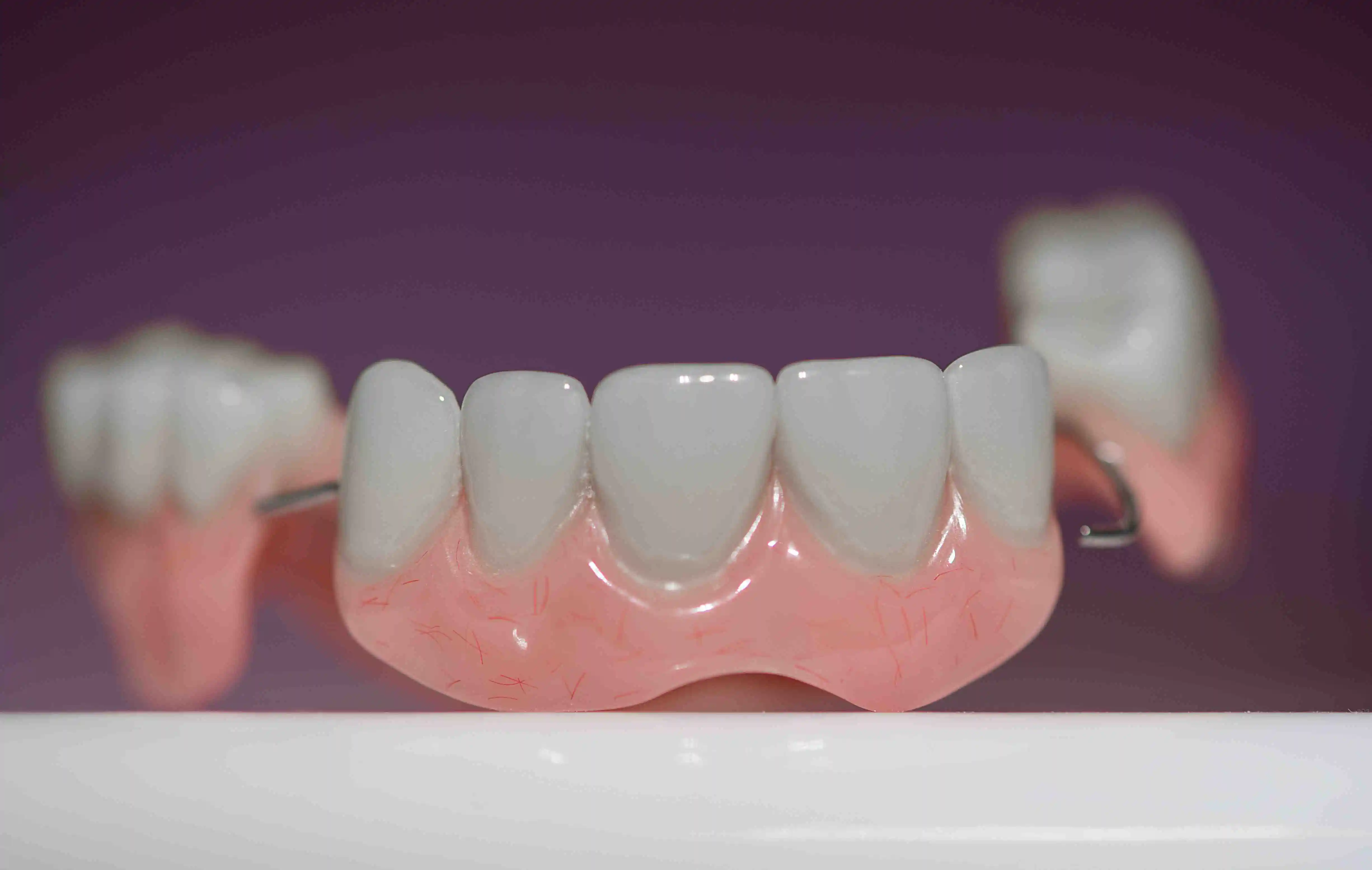 types of dental restoration