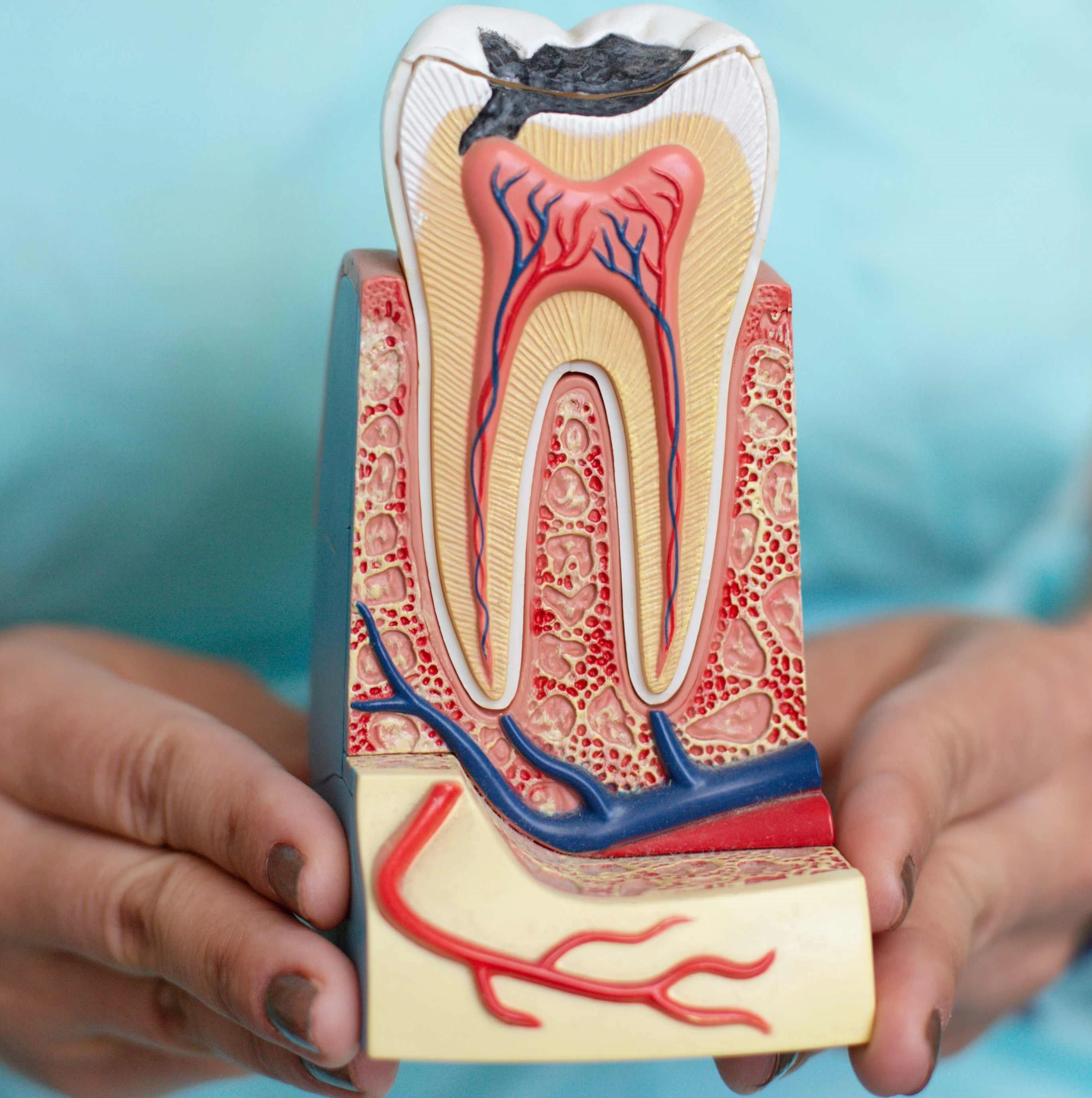 When Do You Need a Root Canal