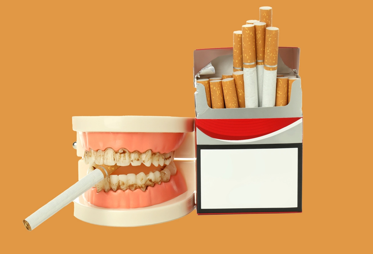 How to remove nicotine stains from teeth 