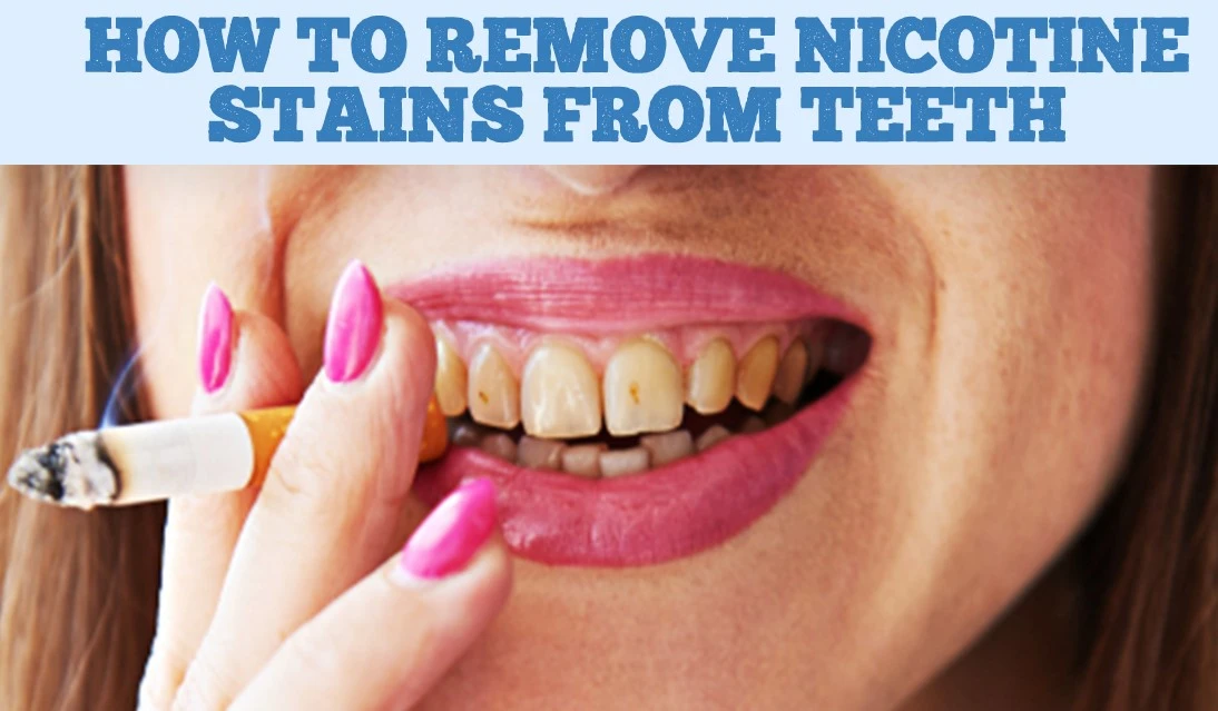 How to remove nicotine stains from teeth