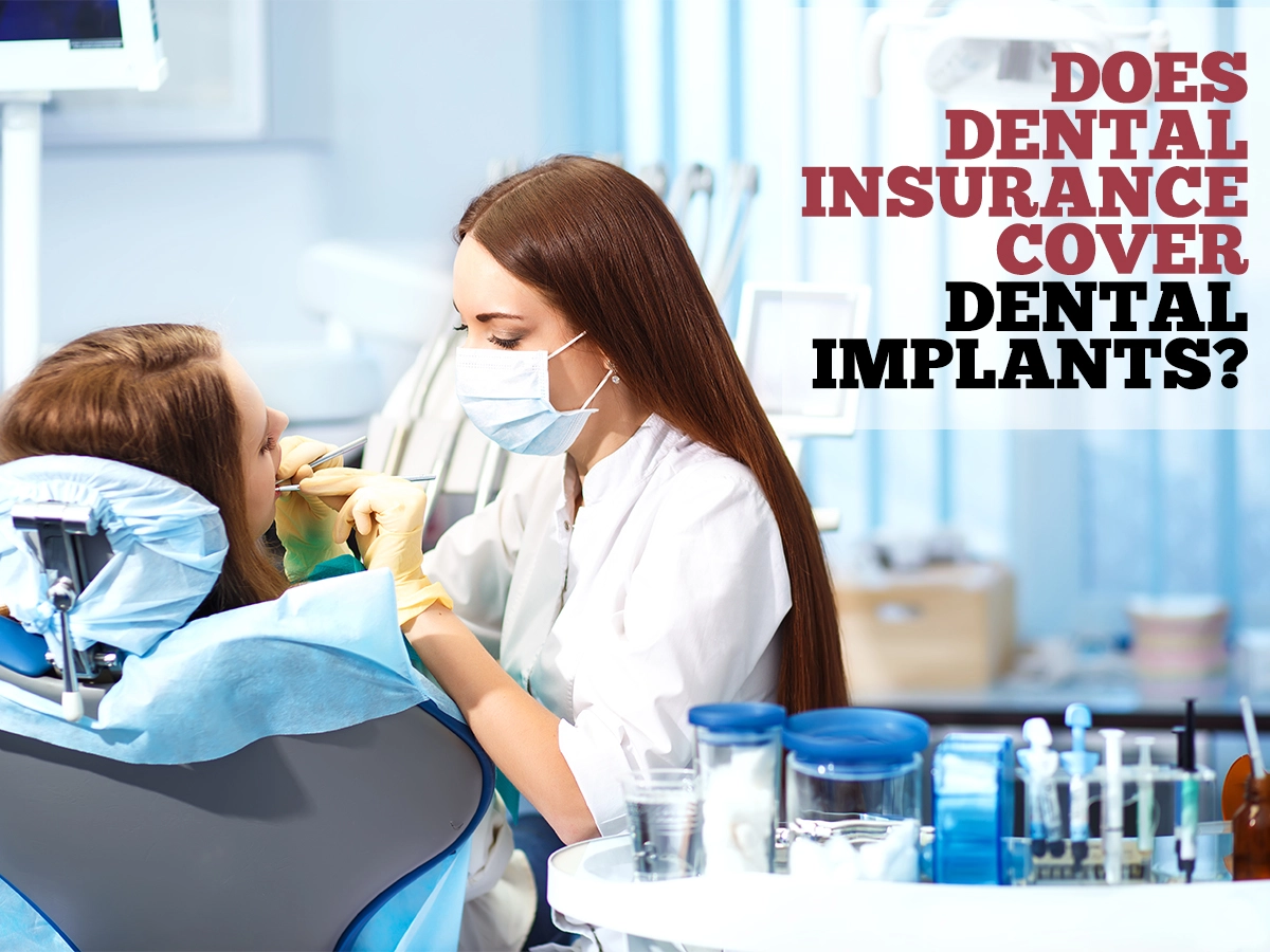 Does Dental Insurance Cover Dental Implants?