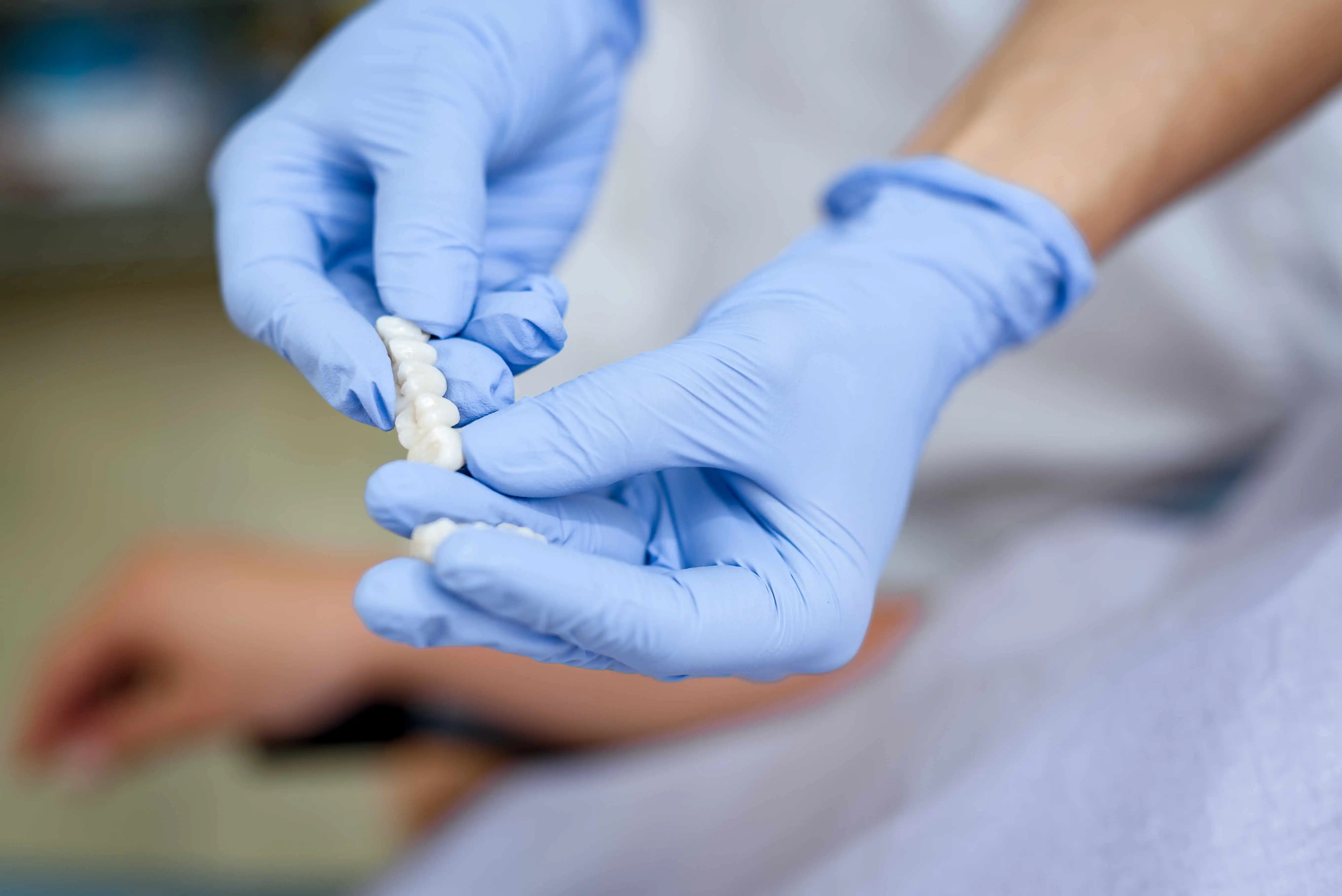 All Porcelain Dental Crowns