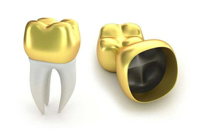 Gold Dental Crowns