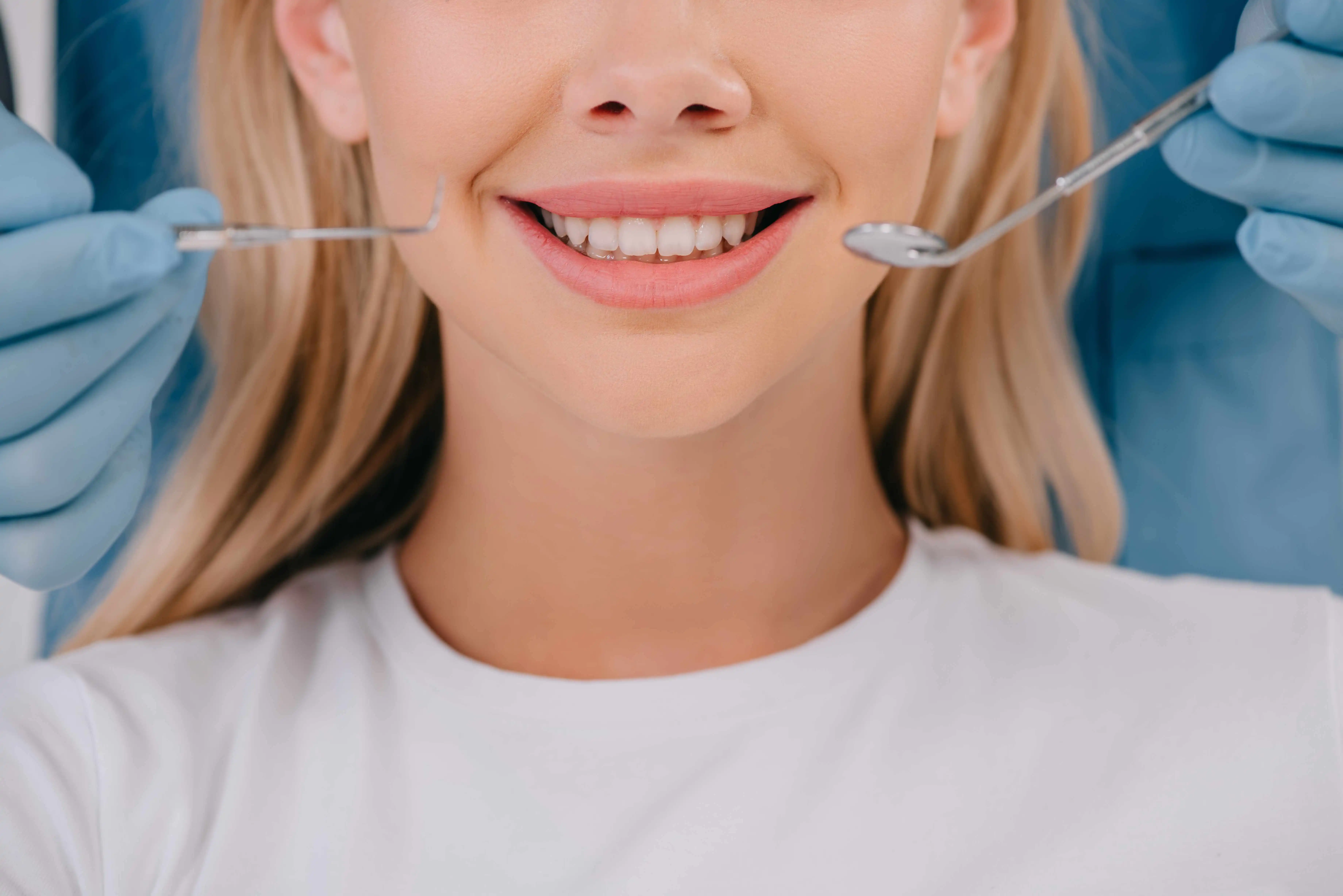 How Long Does Teeth Whitening Last?