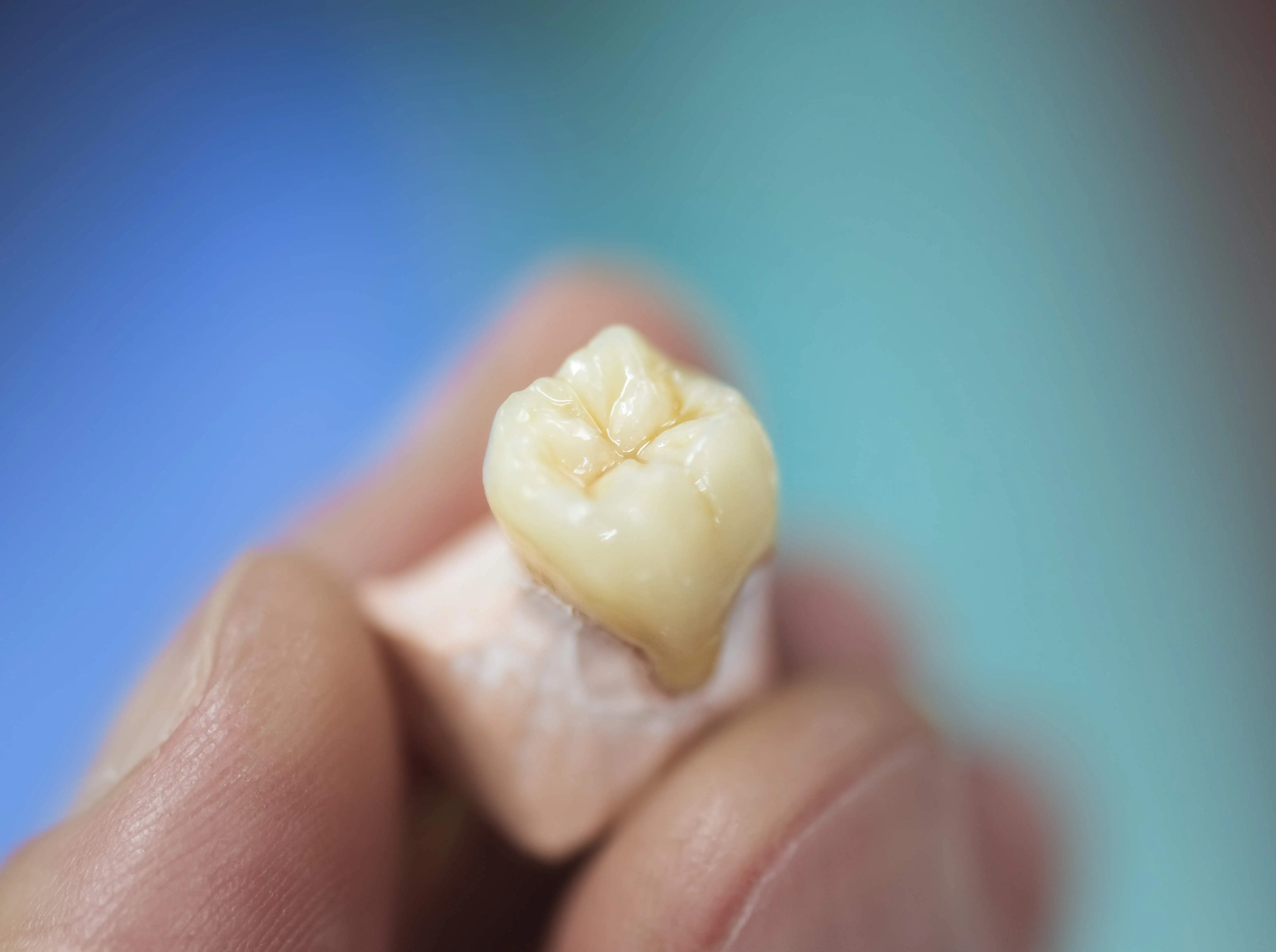 Porcelain Crown Fused to Metal Dental Crowns