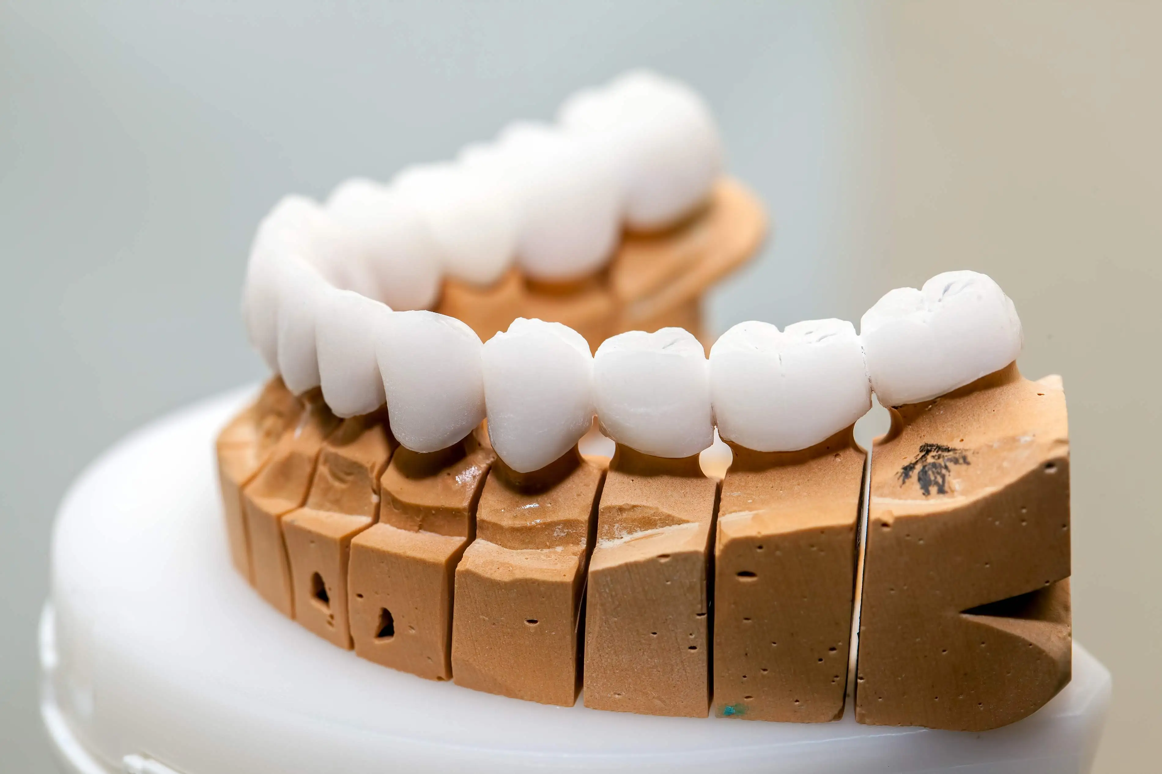 Zirconia Dental Crowns