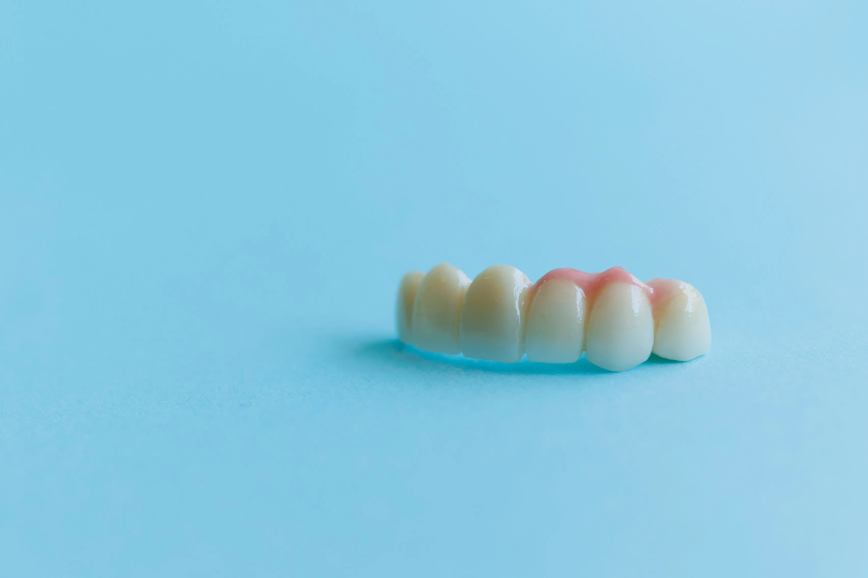 All-On-Four Implant Supported Dentures