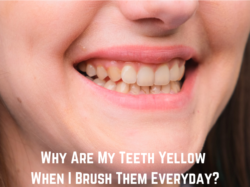 Why Are My Teeth Yellow When I Brush Them Everyday