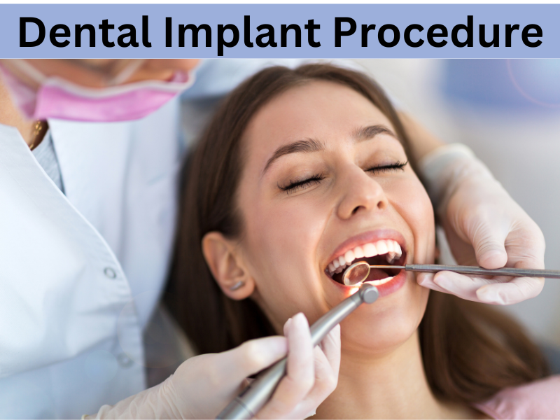 Dental Implant Procedure