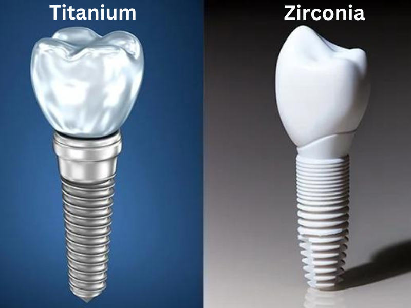What is the Difference Between Zirconia & Titanium