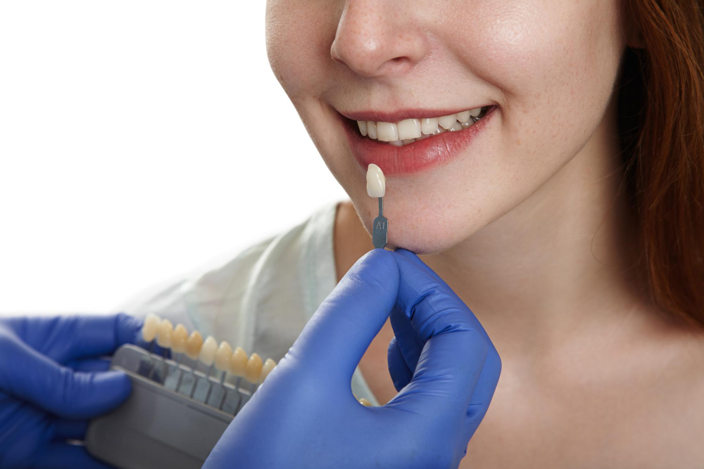 Porcelain Crowns Front Teeth
